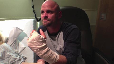Man bites dog's nose off to save wife